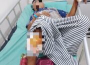 Respons Cepat Polda Sumsel: Polres OKU Beri Pertolongan Medis bagi Korban Serangan Beruang