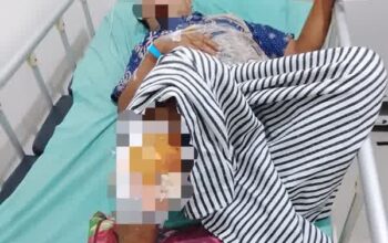 Respons Cepat Polda Sumsel: Polres OKU Beri Pertolongan Medis bagi Korban Serangan Beruang